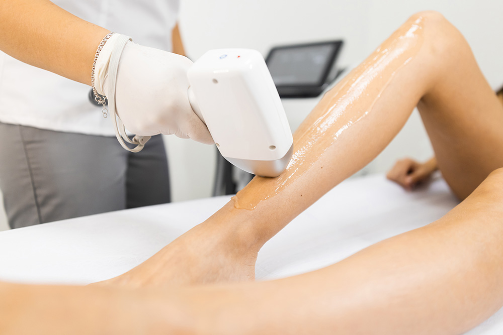 How Long Does Laser Hair Removal Procedure Take