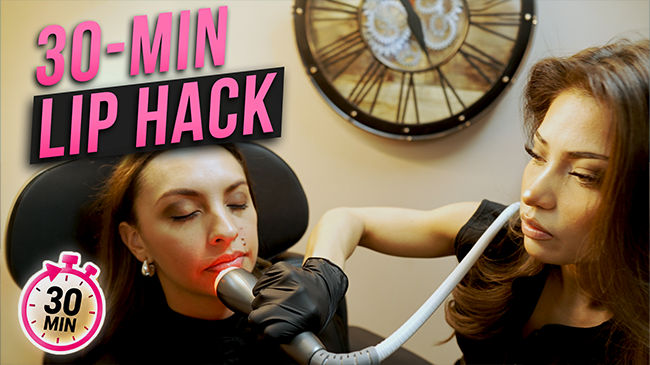 Plump Lips Naturally on Your Lunch Break — No Needles, No Surgery featured image